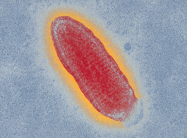 Вирус бешенства под просвечивающим электронным микроскопом (увеличение в 36 700 крат). На компьютерном изображении красным цветом показана белковая оболочка вируса — капсид, а желтым — дополнительная липопротеиновая оболочка